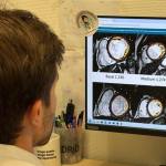 el-puerta-de-hierro-descarta-riesgo-en-un-hallazgo-cardiaco-frecuente